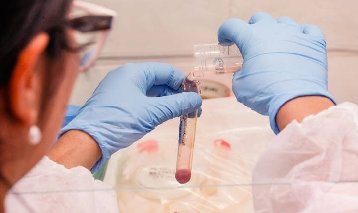 Exame de sangue associado à IA abre caminho para diagnóstico precoce da hanseníase