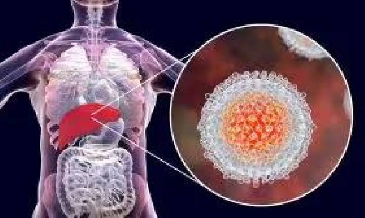 Julho Amarelo: Brasil registra mais de 826 mil casos de hepatites virais e reforça alerta para diagnóstico precoce