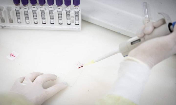 São Paulo investiga caso suspeito de Ebola e mantém vigilância em saúde no estado