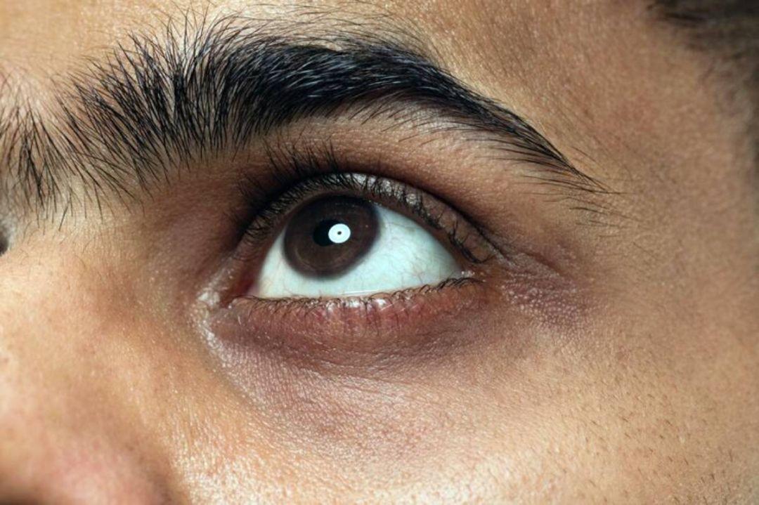 Neurite óptica é mais comum dos 20 aos 40 anos e pode provocar cegueira