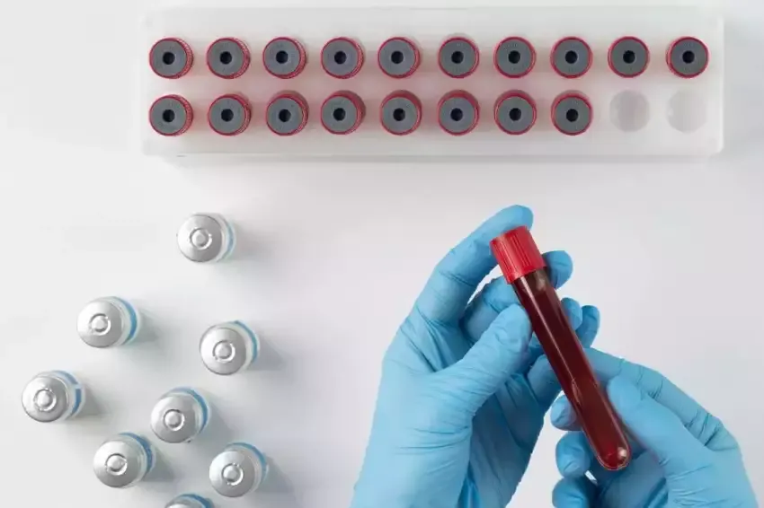 Cientistas desenvolvem nanopartículas em busca da cura do HIV