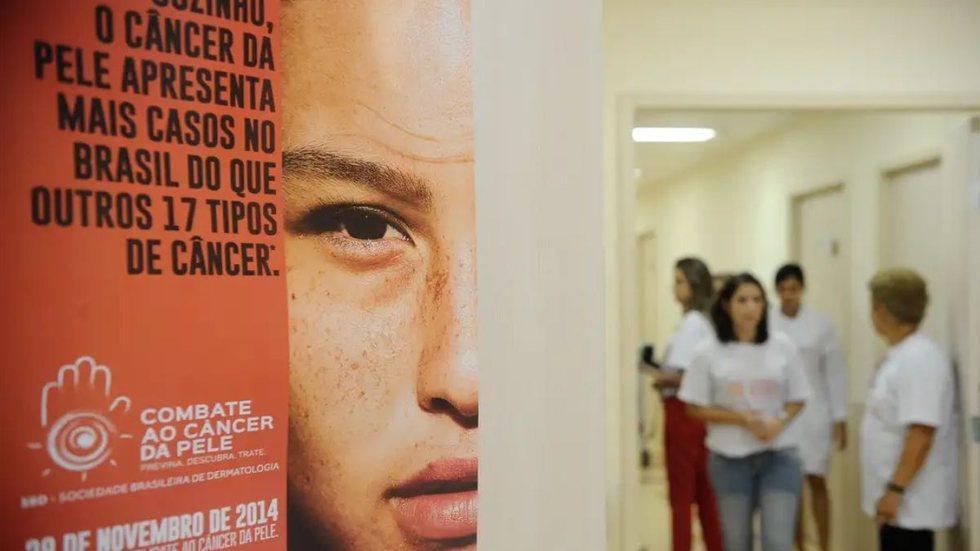 Casos de câncer de pele passam de 72 mil no Brasil