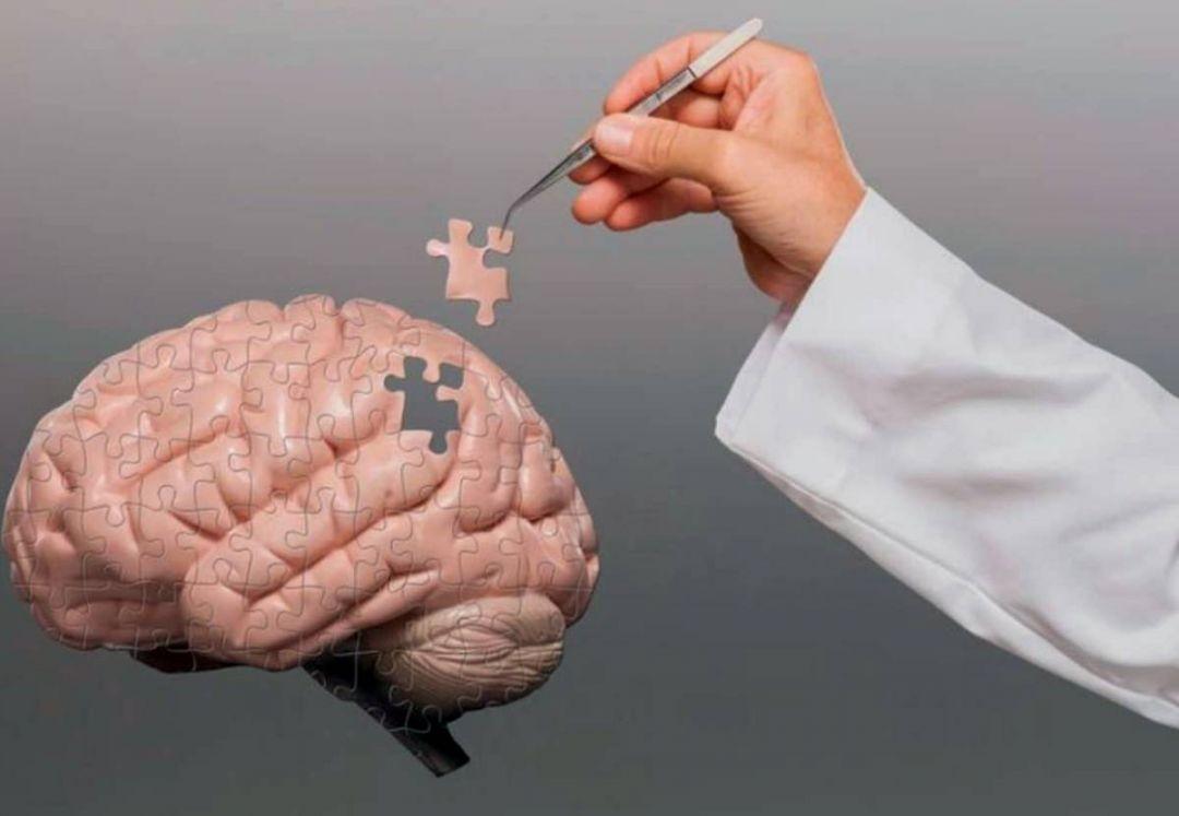 Alzheimer avança no Brasil: SUS registra 56,2 milhões de atendimentos em um ano