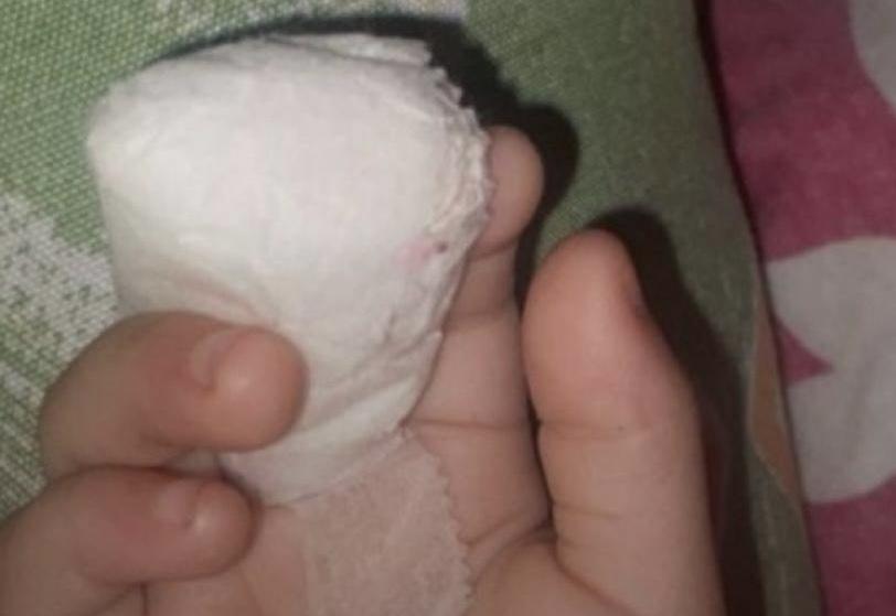 Criança perde ponta do dedo após acidente em creche de Jacareí