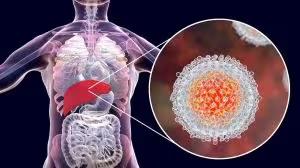 Julho Amarelo: Brasil registra mais de 826 mil casos de hepatites virais e reforça alerta para diagnóstico precoce